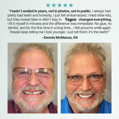 🏆Ends Today: 50% OFF!  🏆2026 Bestselling Product🦷 Fit for a Fresh Smile, Say Goodbye to Wearing Discomfort!🌎