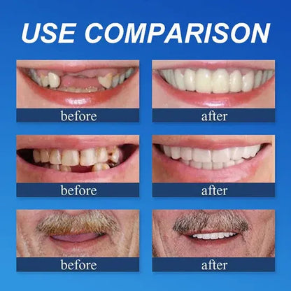 🏆Ends Today: 50% OFF!  🏆2026 Bestselling Product🦷 Fit for a Fresh Smile, Say Goodbye to Wearing Discomfort!🌎
