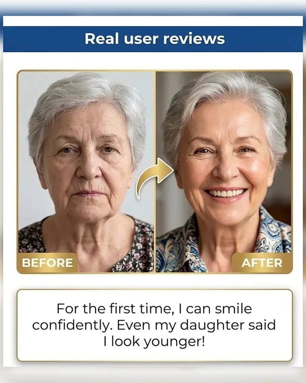 🏆Ends Today: 50% OFF!  🏆2026 Bestselling Product🦷 Fit for a Fresh Smile, Say Goodbye to Wearing Discomfort!🌎